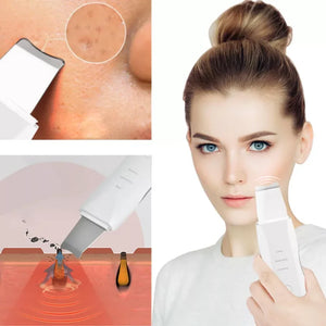 Limpiador Ultrasónico MultiPeel Power