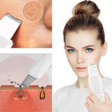 Limpiador Ultrasónico MultiPeel Power