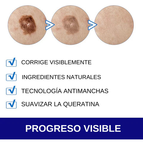 CREMA REMOVEDORA DE VERRUGAS - SUMIFUN 100% ORIGINAL