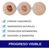 CREMA REMOVEDORA DE VERRUGAS - SUMIFUN 100% ORIGINAL