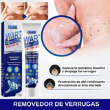 CREMA REMOVEDORA DE VERRUGAS - SUMIFUN 100% ORIGINAL