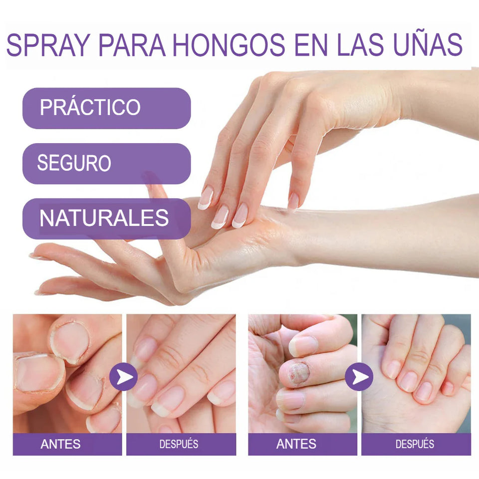 MediNail - Tratamiento para uñas y Pie